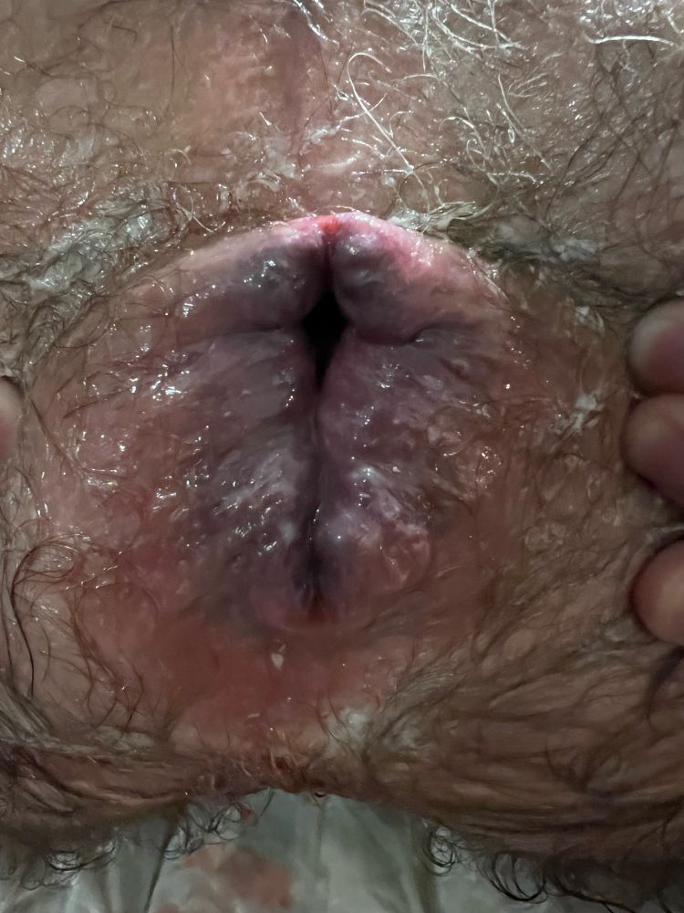 Comment image