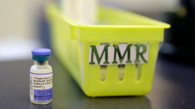 Alberta's measles outbreaks surpass case counts reported for entire U.S. | CBC News