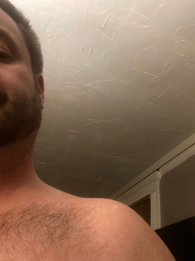 Pic of my shirtless left shoulder 