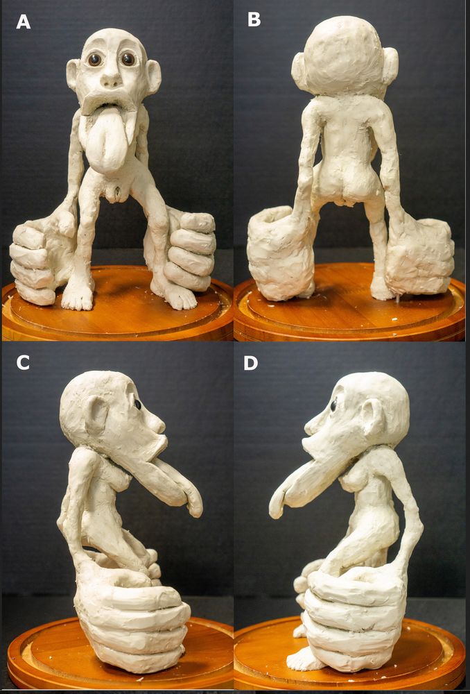 Female homunculus with huge lower lip and tongue and scrotum-sized labia