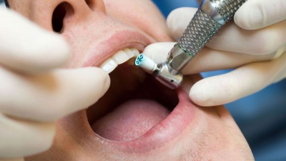 The people who can’t go numb at the dentist’s