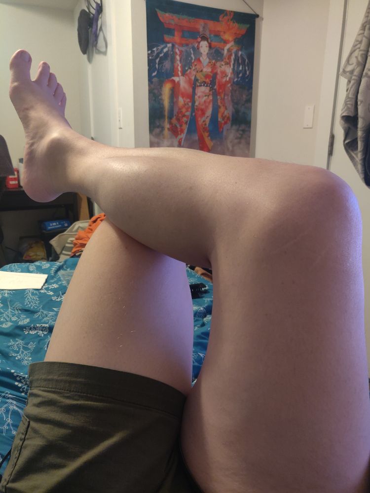 My legs.