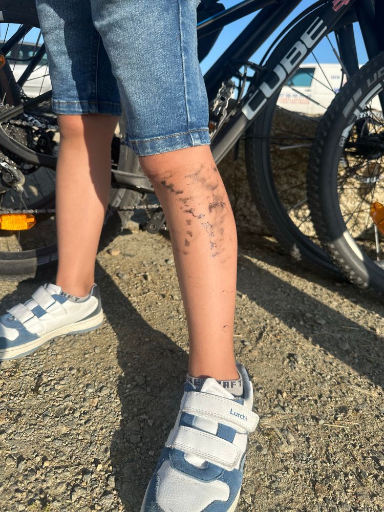 Kinder-Beine, mit den öligen Abdrücken eines Kettenblatts vom Fahrrad