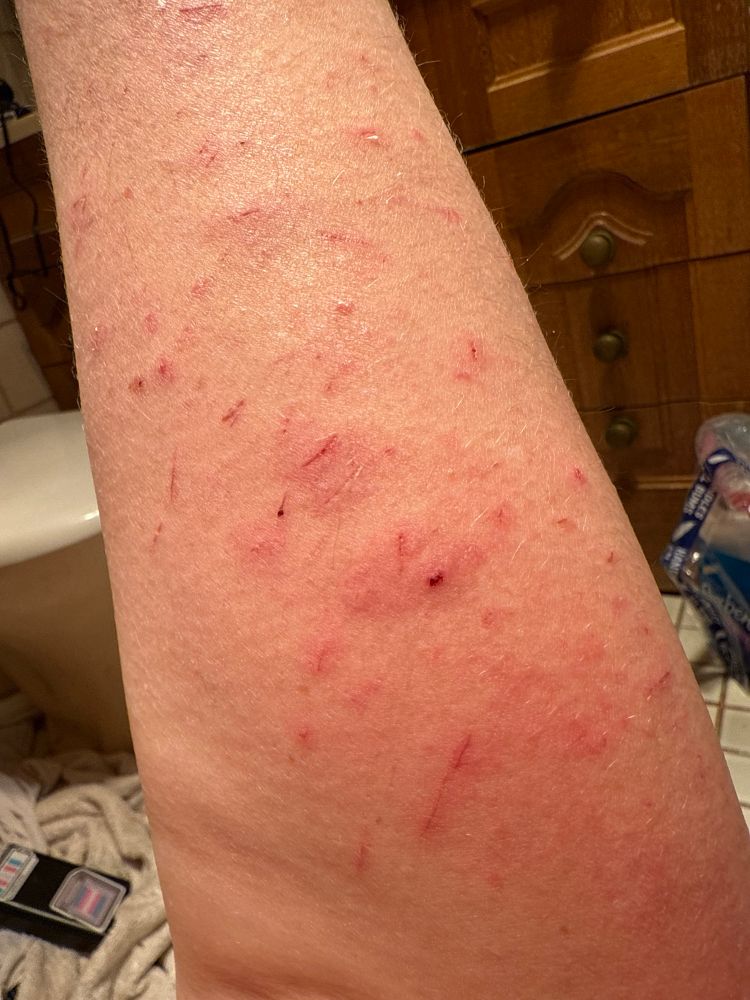 Claw marks from a kitty tapping my arm to be fed 