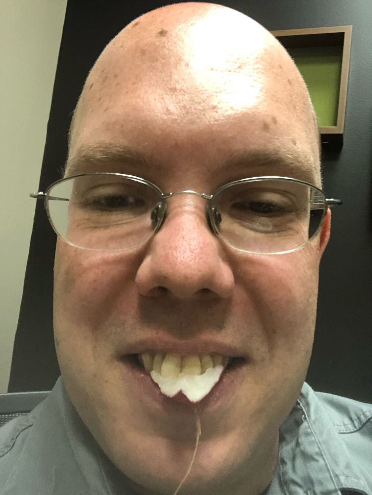 Me in 2019 (bald, clean-shaven, business casual) with half a radish in my teeth. 