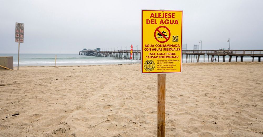 Warning sign at Imperial Beach, Calif. Photo: Erik Jepsen/UC San Diego