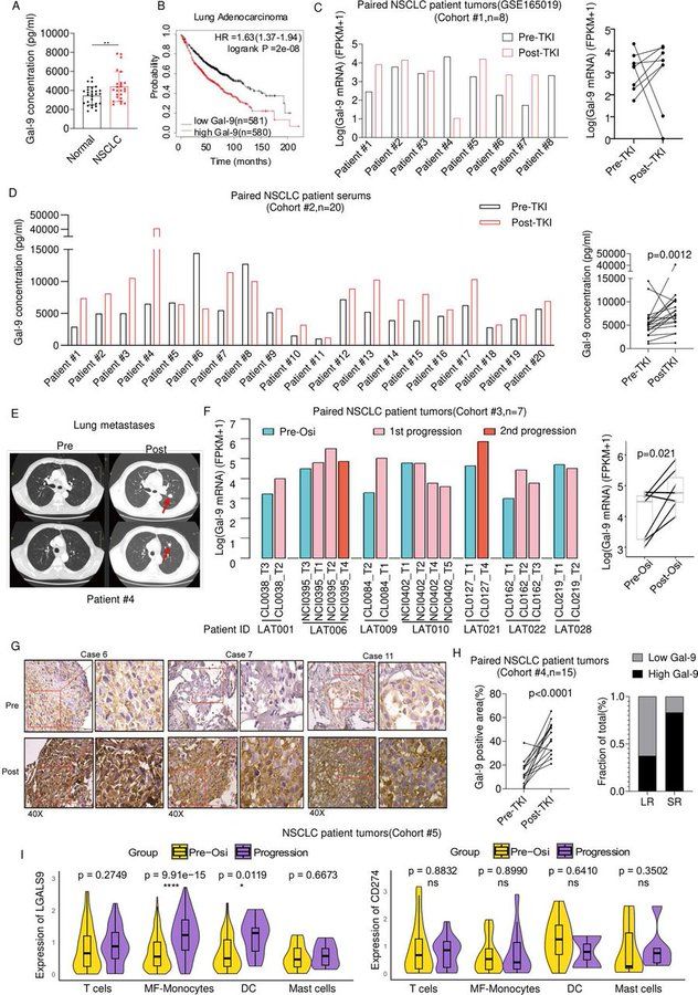 New Journal for ImmunoTherapy of Cancer article: Anti-galectin-9 therapy synergizes with EGFR inhibition to reprogram the tumor microenvironment and overcome immune evasion https://bit.ly/4lBt5zj 🧪

#JITC #MedSky #ImmunoSky #tumor #OncSky

Background Despite the remarkable clinical outcomes of epidermal growth factor receptor (EGFR)-targeted therapies in patients with lung cancer, therapeutic resistance eventually develops. This study e...