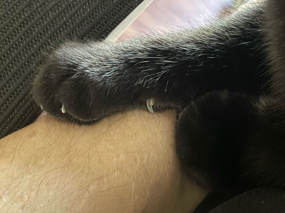 A person’s arm with a black cat’s paw ontop of it with the cat’s sharp nails showing. 