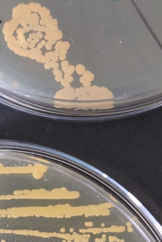 Pink bacteria on top. Yellow bacteria on bottom.