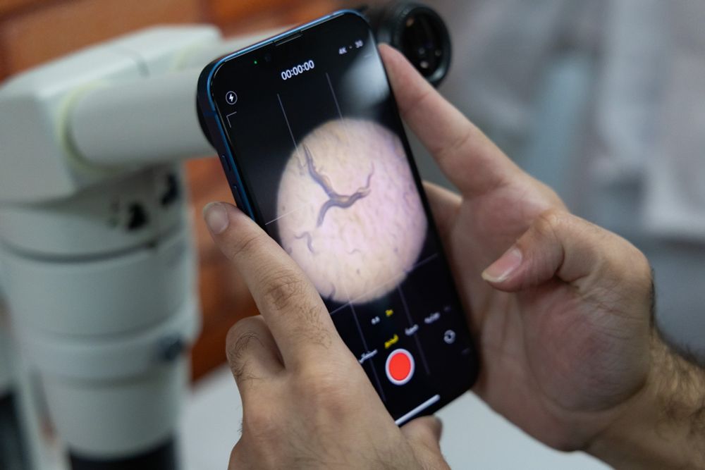 A phone is used to take an image of C. elegans down a microscope
