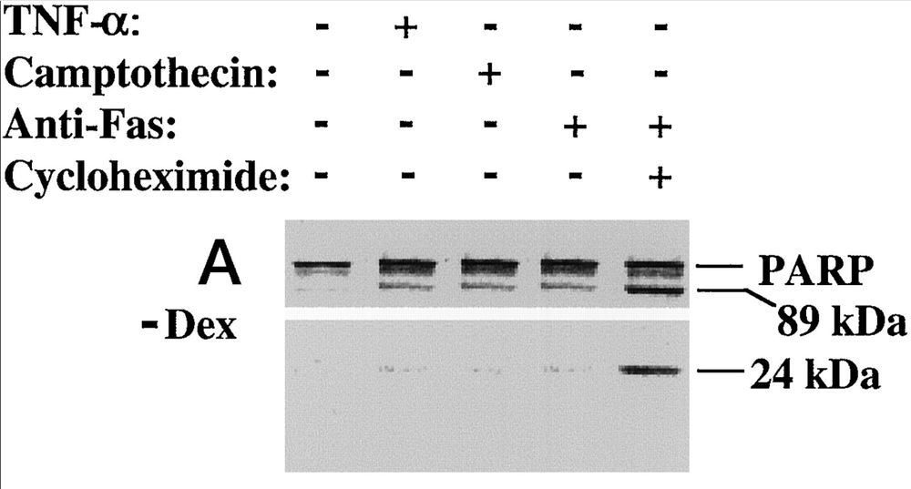 Two protein blots, grey panels in black horizontal stripes. At the top, several labels indicate (with + and -) the addition of 4 different compounds.