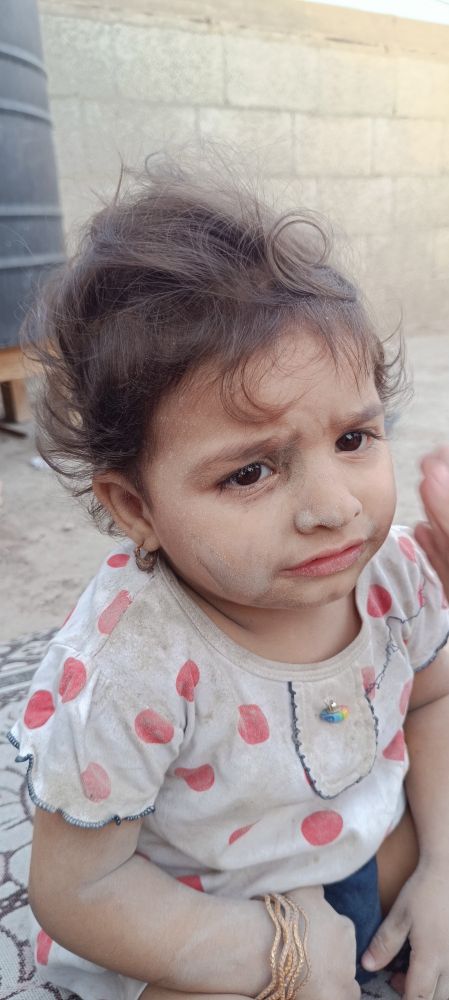 A photo of a little Palestinian girl, it is full of dust. The girl survived a bomb attack and is obviously traumatised. The photo is taken while displacement and famine in genocide. It is heartbreaking.