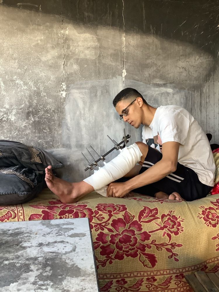A photo of a young palestinian man. 
You can see that his leg is badly injured. He is sitting in a tent.
The young man's name is Samed.
The photo is taken while displacement and famine in genocide.