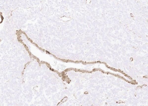 SMA negative. 