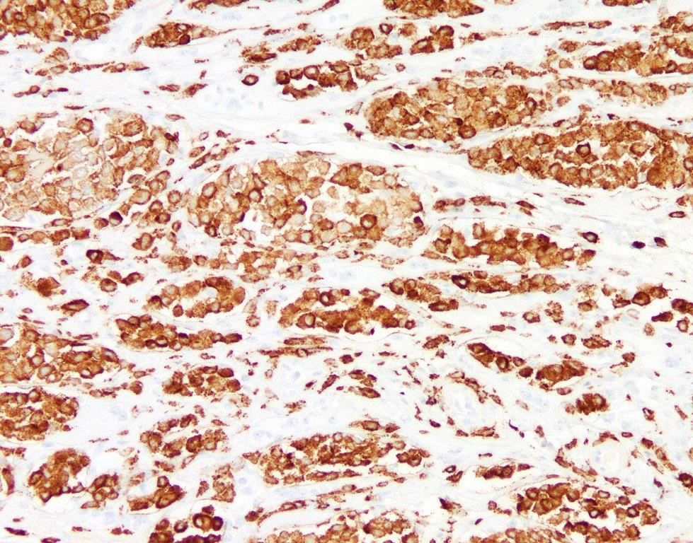 CD163