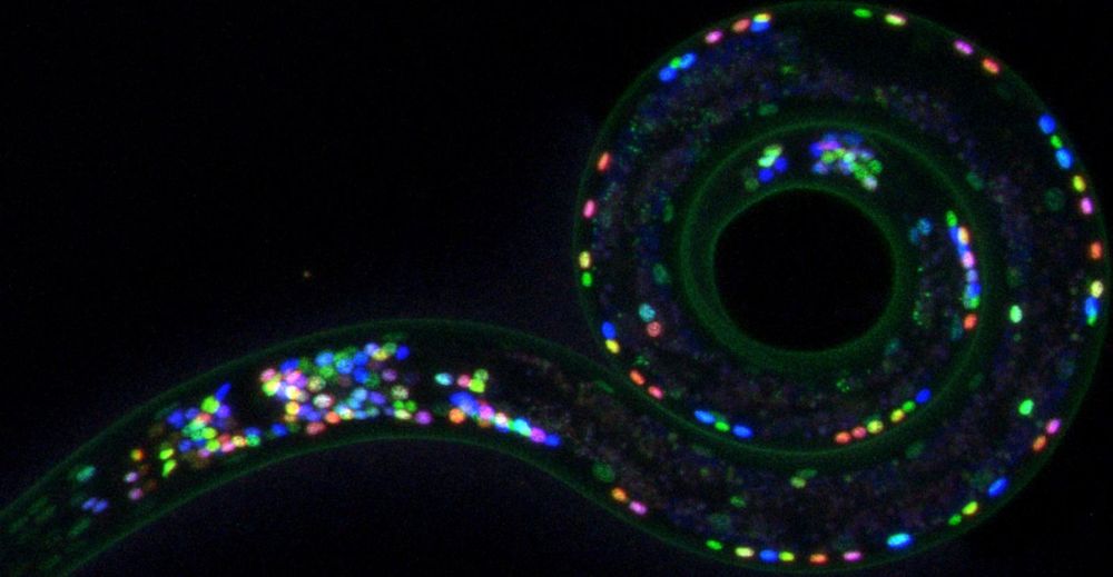 a dauer neuropal worm -- image from oliver hobert's website https://www.hobertlab.org/worm-neuron-gallery/