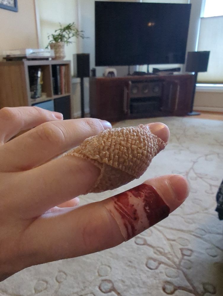 Photo of a hand. The index finger has a bacon themed bandaid on it, while the middle finger has a large wad of medical tape wrapped around it holding a pad in place over some stitches. 