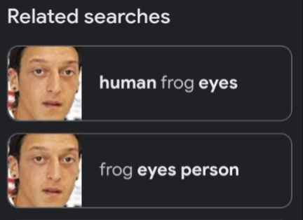 Related searches: human frog eyes / frog eyes person (two images of Mesut Ozil)