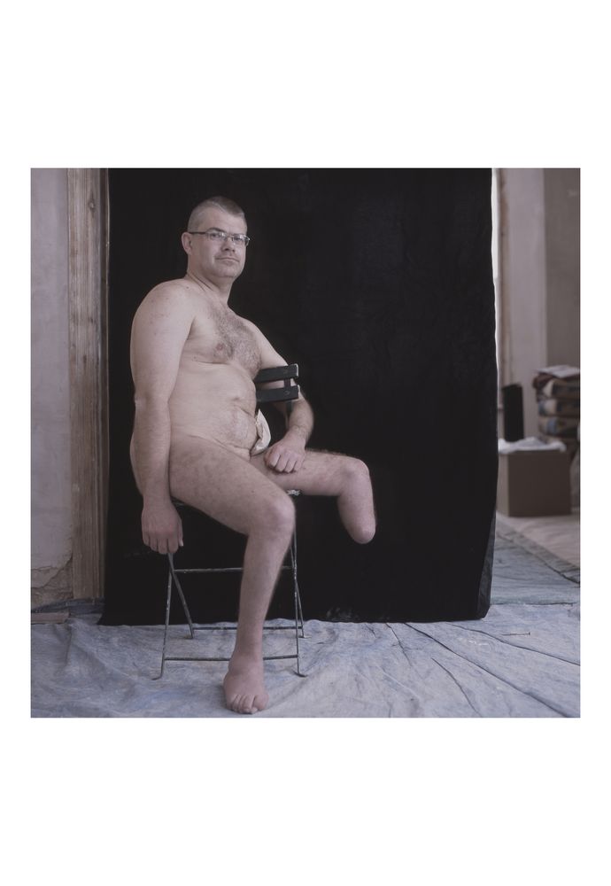 A nude man sat side on on a folding chair making eye contact with the camera. He's a below knee amputee 