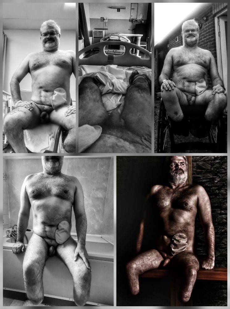A collage of nudes showing different stages in my amputee journey 