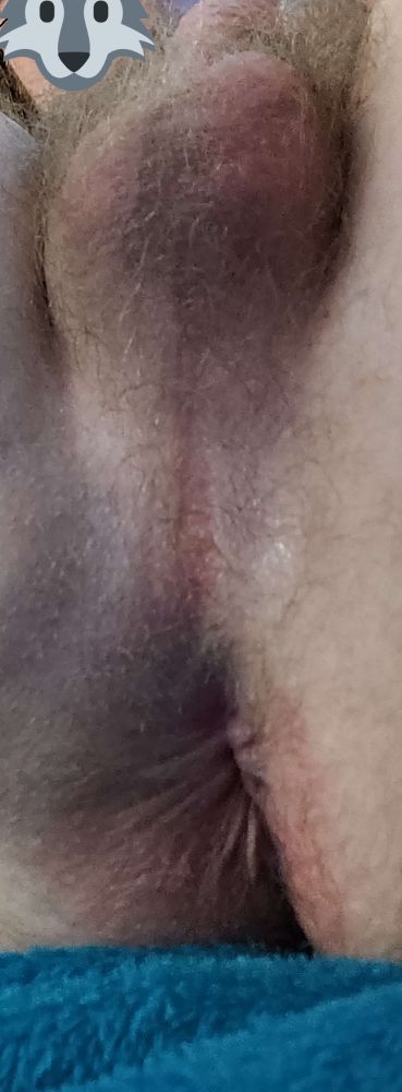A fun shot of the posters butt hole that shows of both his taint and balls as well!

Once again his face is barely hidden by the same wolf emoji he likes to use, but is unfortunately not fully covered because all the way he uses to do it have gotten worse to the point where he can't even resize or rotate it?? Why??