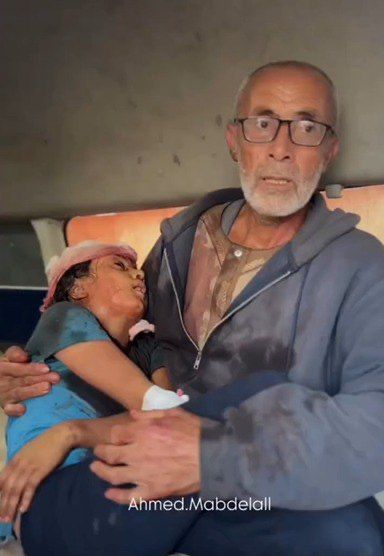 An older Palestinian man sits in a vehicle holding an injured young girl in his lap. The girl appears unconscious or weak, her face bloodied and her hair covered with a bandage. The man looks distressed but composed, wearing glasses and a grey hoodie. The scene conveys urgency and grief.
