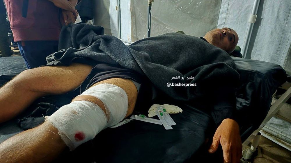 An injured man lies on a hospital bed covered with a blanket. His leg is wrapped in thick white bandages with a blood spot showing through. Medical syringes and supplies lie on the mattress beside him. The scene appears to be inside a makeshift medical tent. Watermark “@basherprees” is visible.