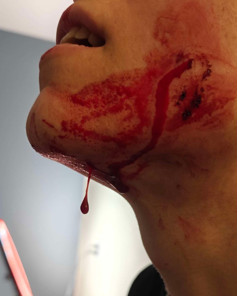 Coagulated blood hangs from her bloodied face 