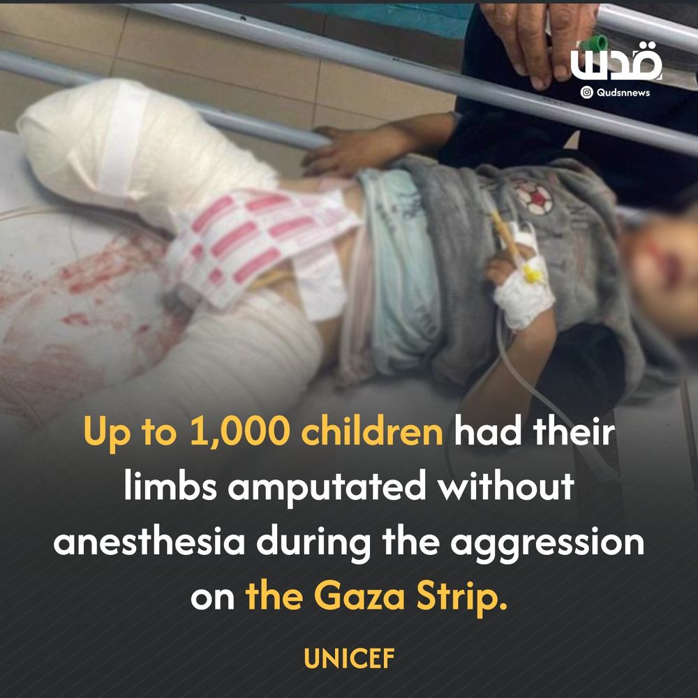 Up to 1,000 children had their limbs amputated without anesthesia during the aggression on the Gaza Strip. - UNICEF