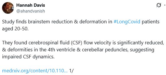 Study finds brainstem reduction & deformation in #LongCovid patients aged 20-50.

They found cerebrospinal fluid (CSF) flow velocity is significantly reduced, & deformities in the 4th ventricle & cerebellar peduncles, suggesting impaired CSF dynamics.

https://medrxiv.org/content/10.1101/2025.04.08.25325108v1 1/