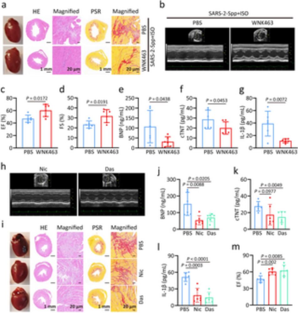 SARS-CoV-2 spike-induced syncytia are senescent and contribute to exacerbated heart failure