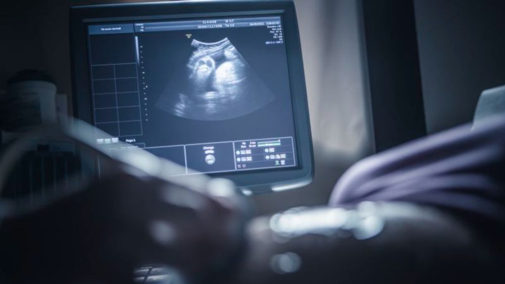 The American College of Obstetricians and Gynecologists on Friday reaffirmed support for Covid-19 vaccination during pregnancy, becoming the second major professional medical association to break from...
