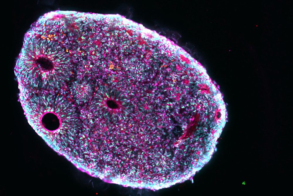 Day 50 cortical organoid stained for KI67 (red), MAP2 (magenta), Hoechst (cyan); image credit: Oliviero Leonardi