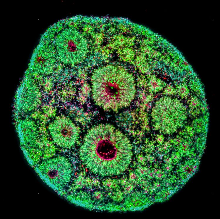 [Cortical Organoid image acquired by Oliviero Leonardi]