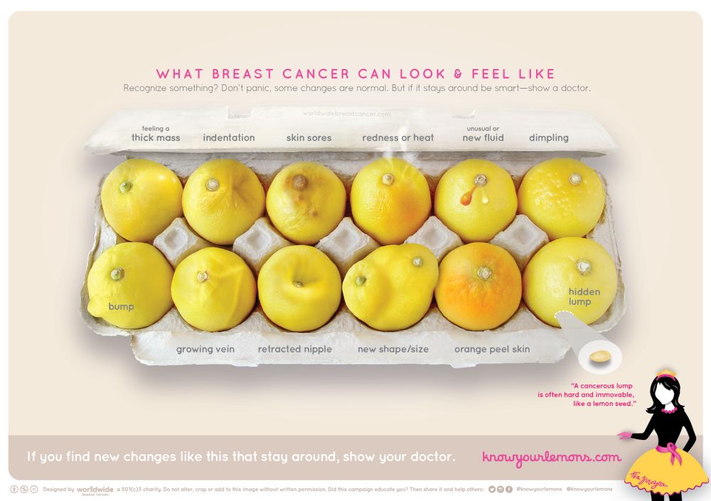 Know Your Lemons image showing lemons indicating various potential indicators of breast cancer. 