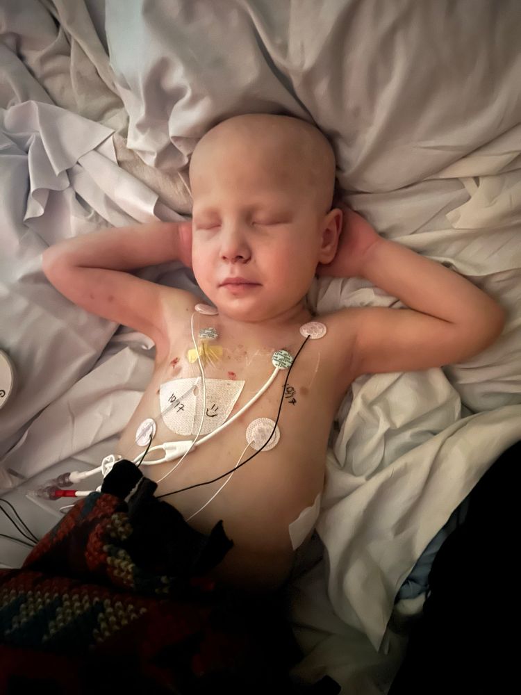A bald boy of very nearly 4 years, sleeping shirtless in a hospital bed. He has multiple tubes (one from an accessed central line port, two from a “broviac” port) running from his chest, as well as heart monitoring stickers and wires.