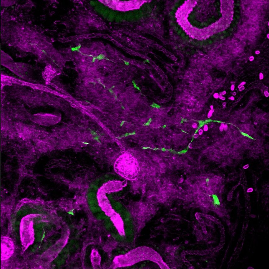 GFP+ stem cells moving through the complex environment of a zebrafish kidney. 
