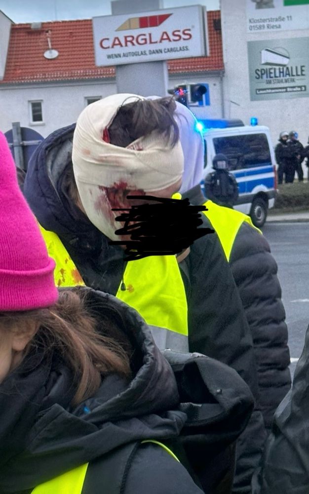 Demonstrant mit gelber Weste und Verbandsturban am Kopf, aus dem Blut sickert.