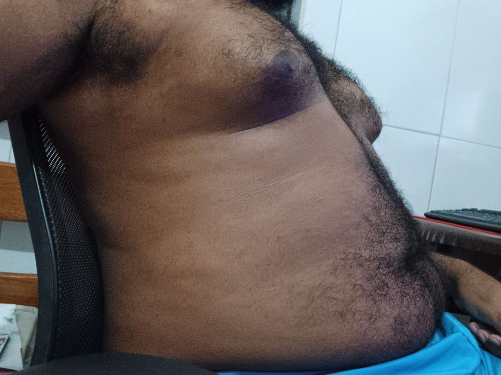 Picture showing a fat torso, with hairy armits, chest and belly, sitting down on a chair