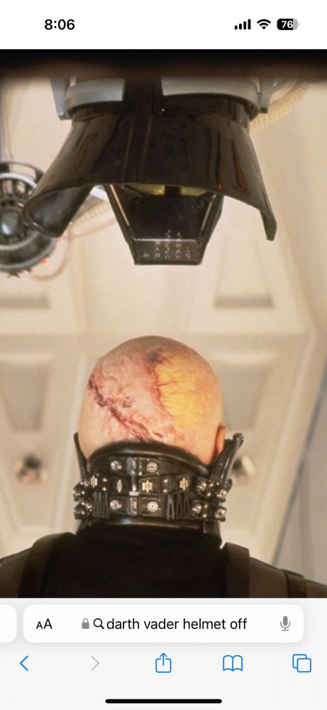 Darth Vader’s scarred, hairless, pasty-white scalp. 