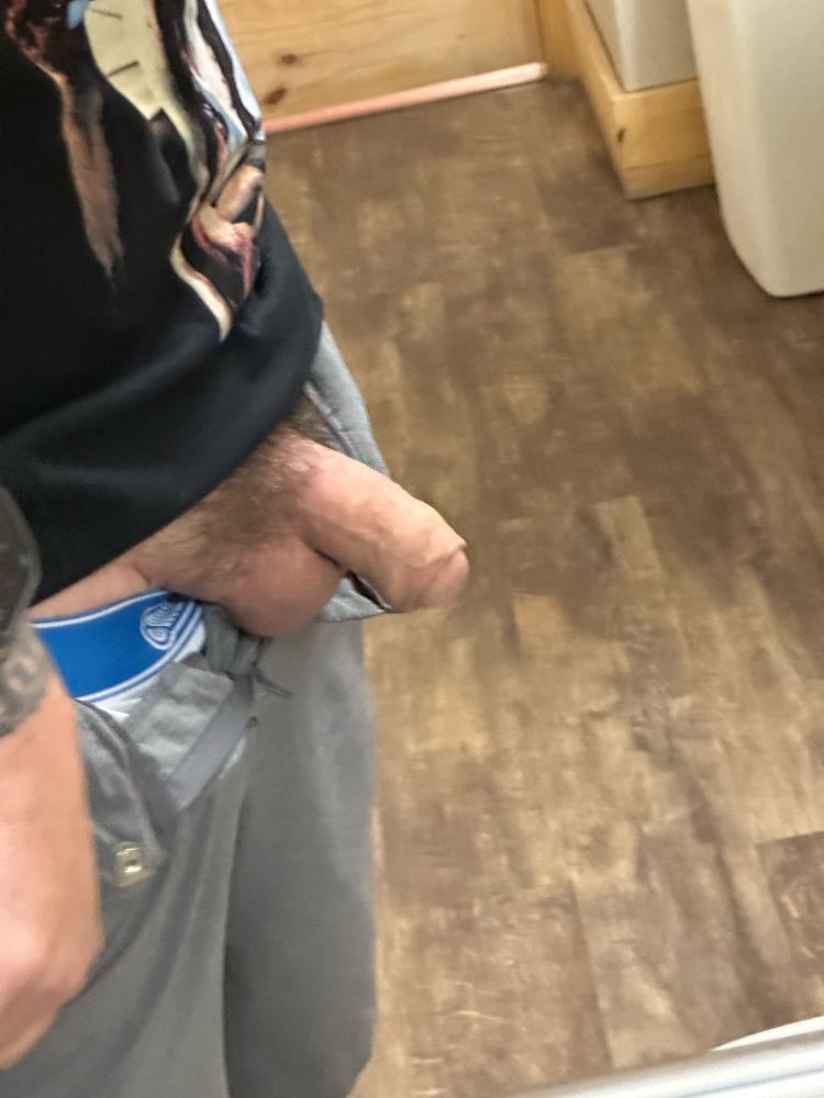 Foreskin Restoration Progress