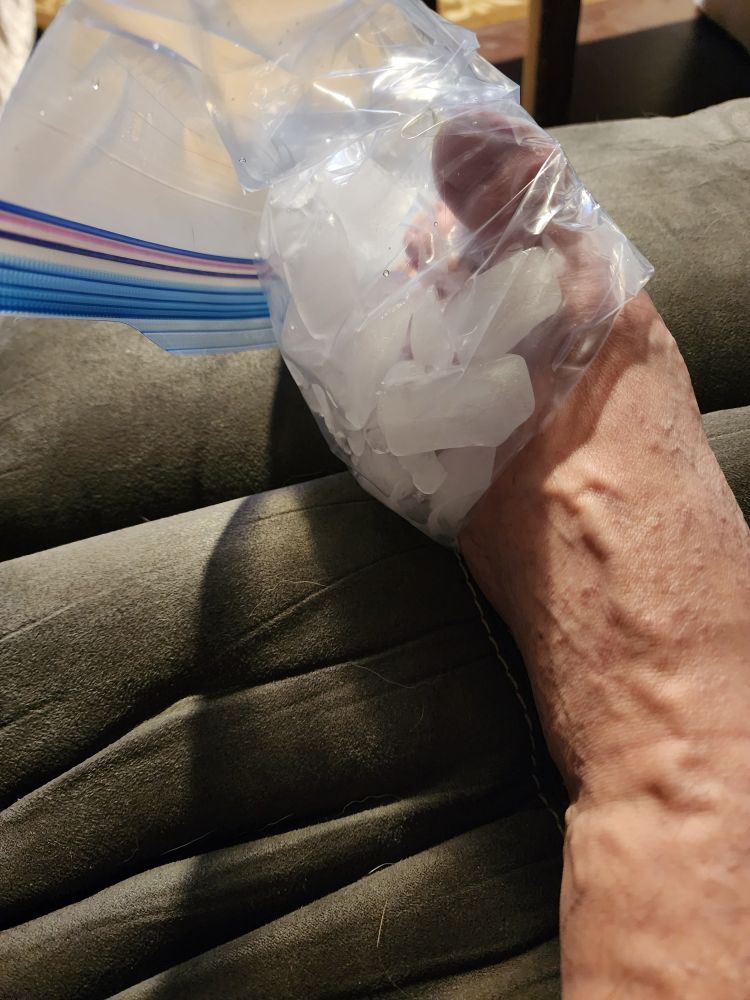 My foot, with small toe wrapped with ice in a ziplock bag