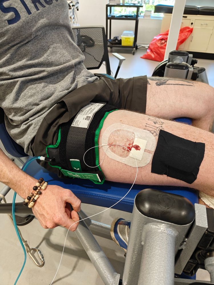 Experimental set-up with intramuscular pressure catheter inserted into right vastus lateralis under the mNIRS sensor.