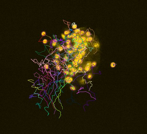 Fluorescent microscopy image of cells with tracks.