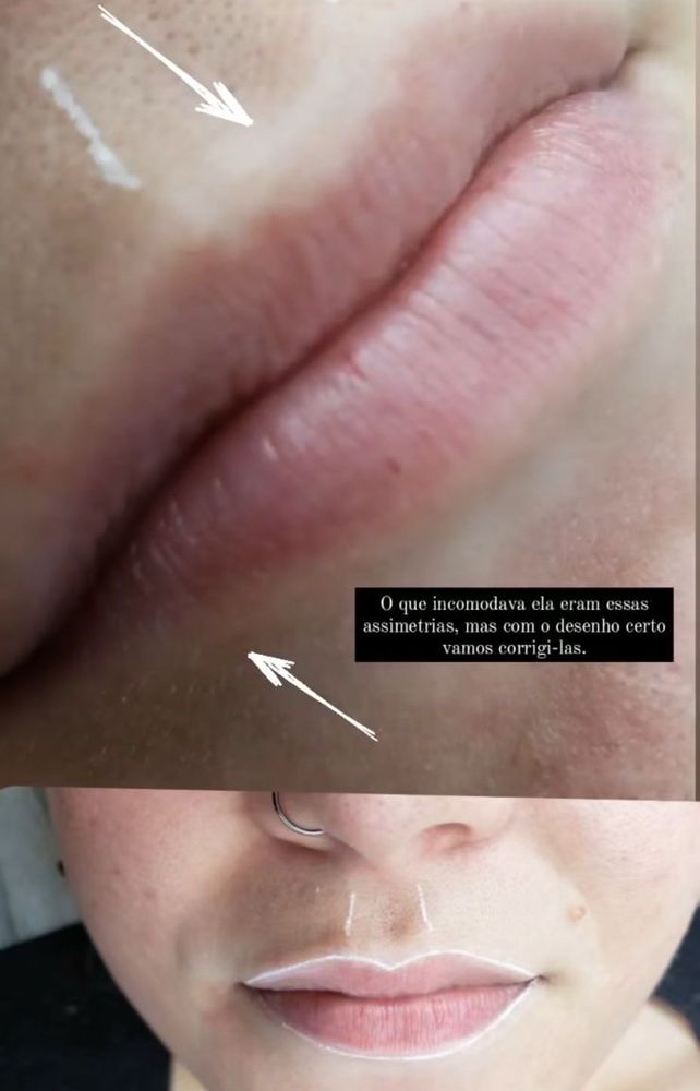 foto da minha boca sem a micropigmentação labial