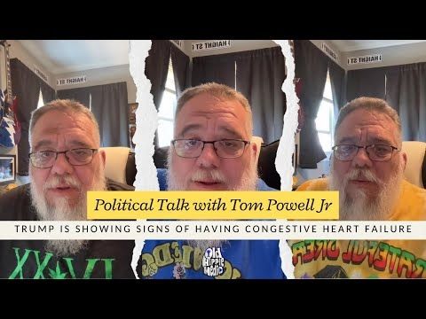 Trump is showing signs of having congestive heart failure