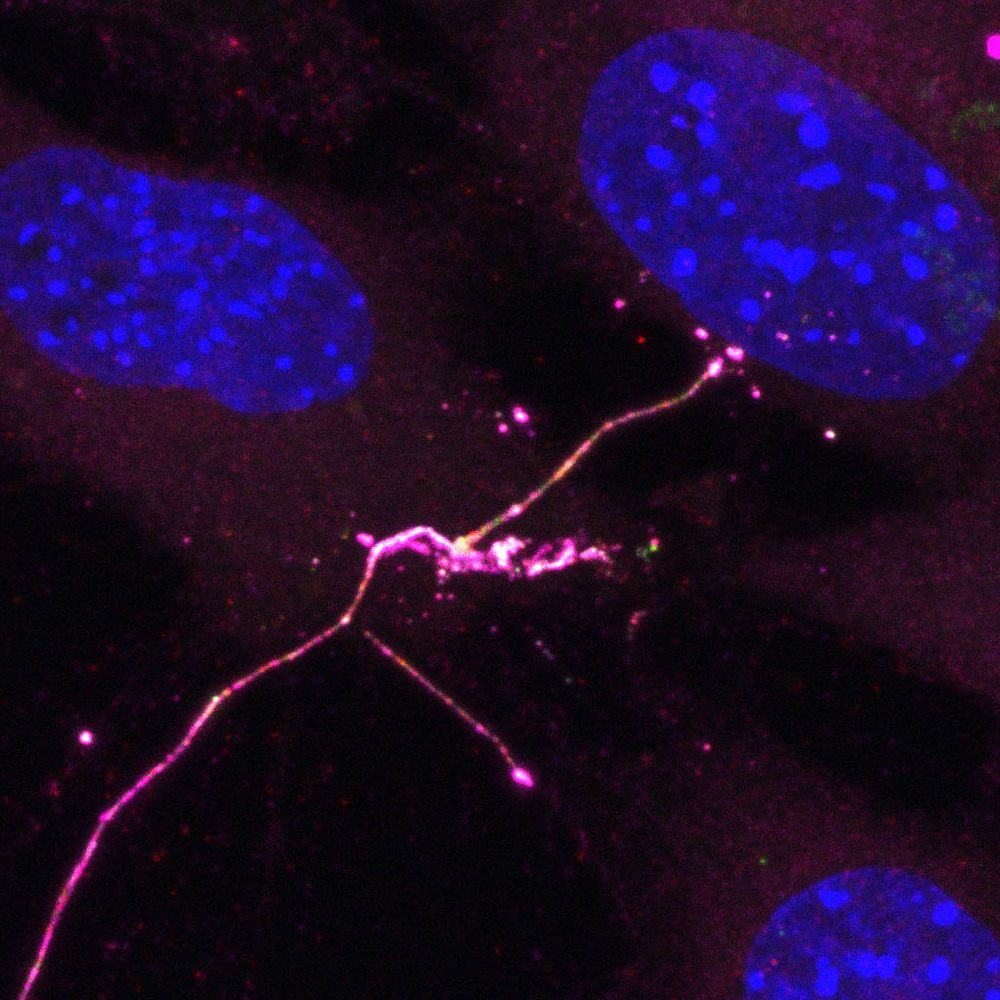 NIH3T3 cells with a long cytoneme contacting one of the cells to deliver a signal. The SHH ligand is in magenta, the SHH transport protein DISP is in red. Nuclei are blue. Green is the adhesion protein BOC. 