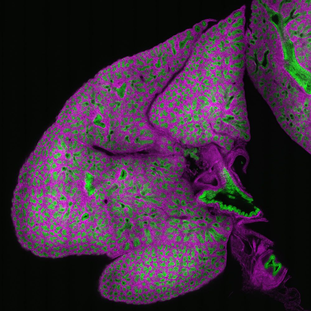 A confocal image of an E18.5 mouse lung showing Shh-expressing cells in green and non-expressing cells in magenta. Image was acquired on a Nikon A1R. 