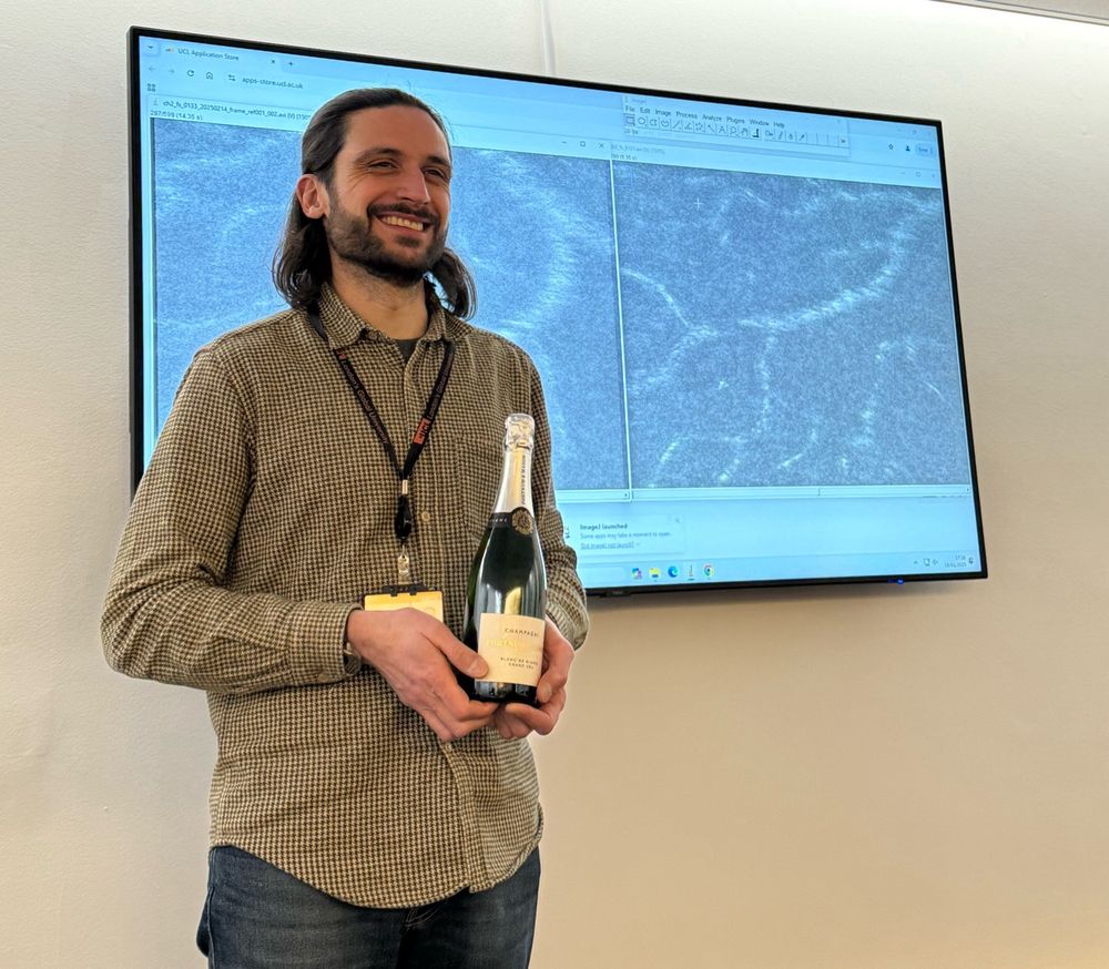Bruno in front of a screen with retinal images, holding an unopened bottle of champagne 