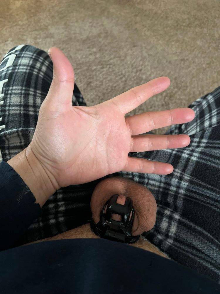 A picture of my nub in a black kink3D cage next to my open palm.